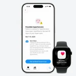 Apple-Watch